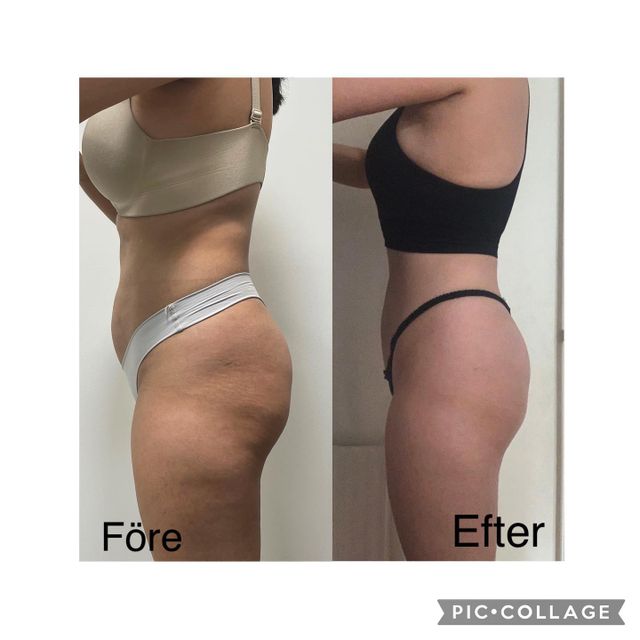 kroppsbild före och efter