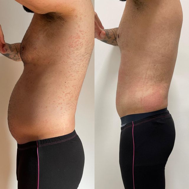kroppsbild före och efter